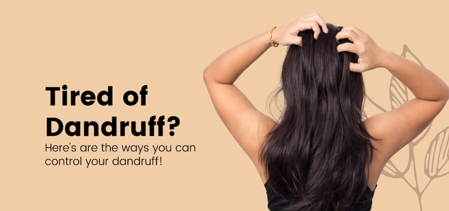 Tips to help you get rid of Dandruff